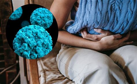 norovirus que es y sintomas